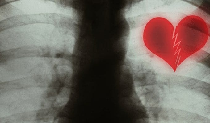 Из-за разбитого сердца действительно можно умереть, утверждают кардиологи ›